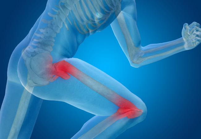 The Connection Between Hip and Knee Pain